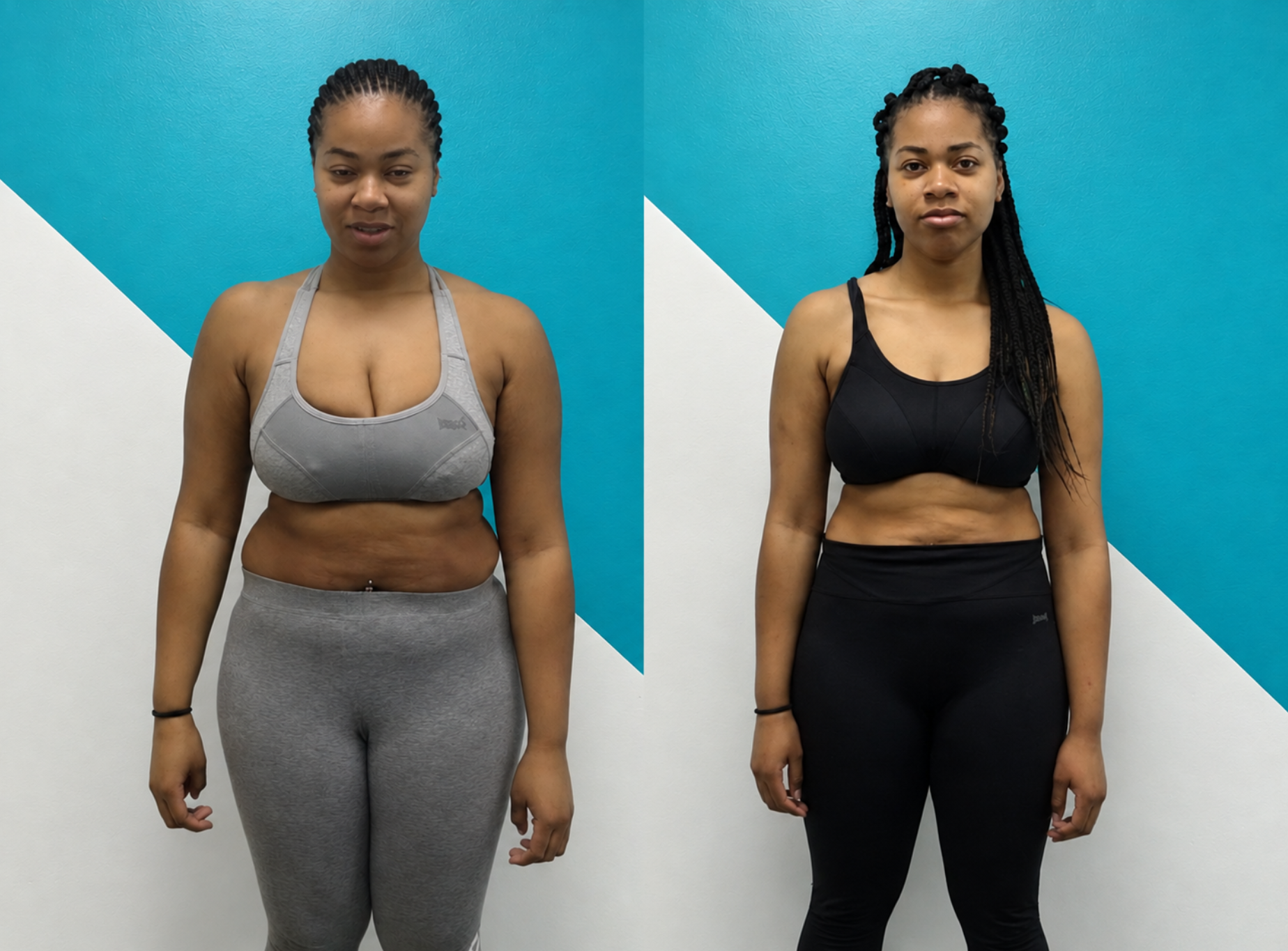Bethany before and after