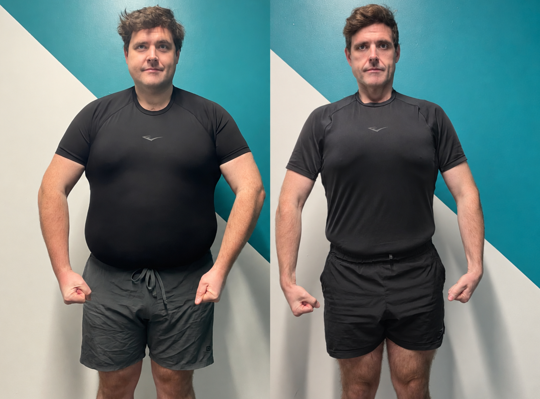 Tom before and after