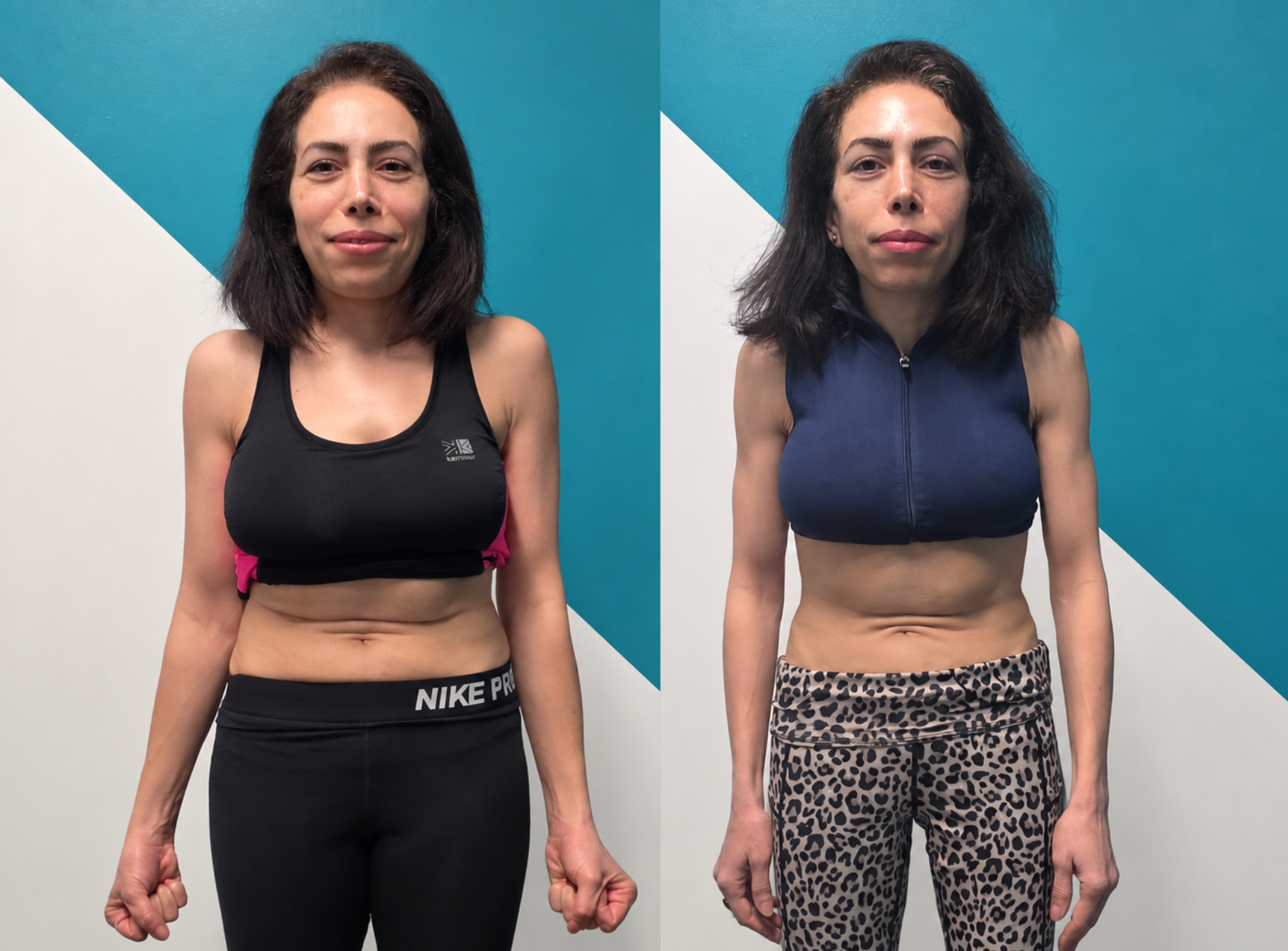 Amy before and after