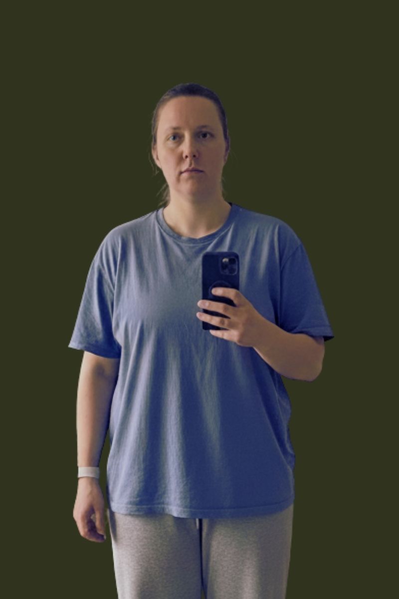 Vorher-Foto – Vergleich 2