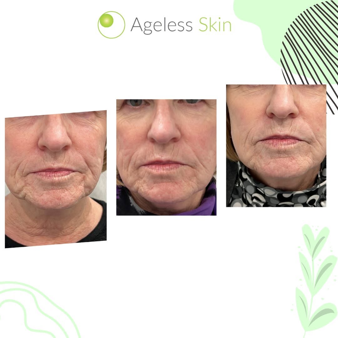 Client before and after result 9