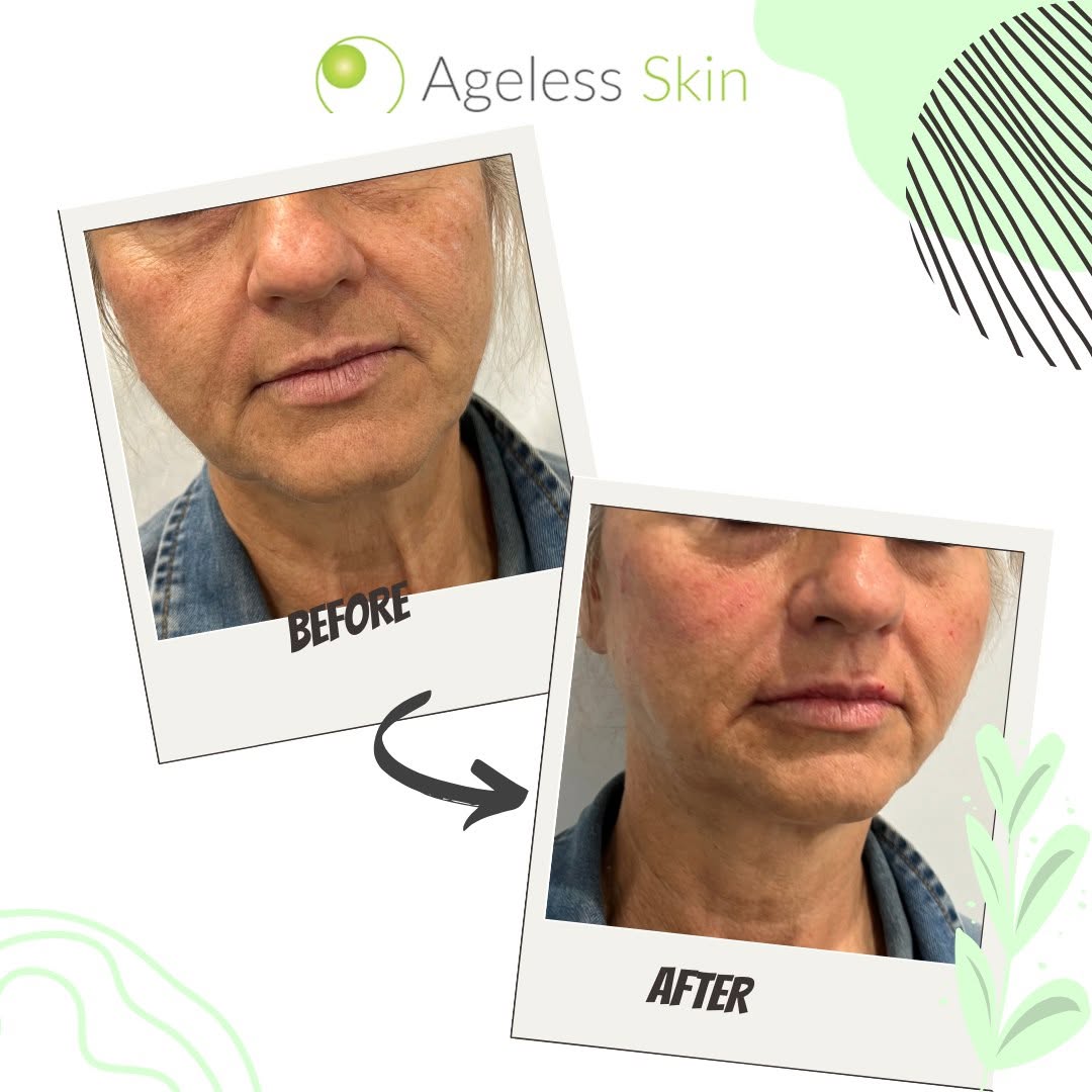 Client before and after result 6