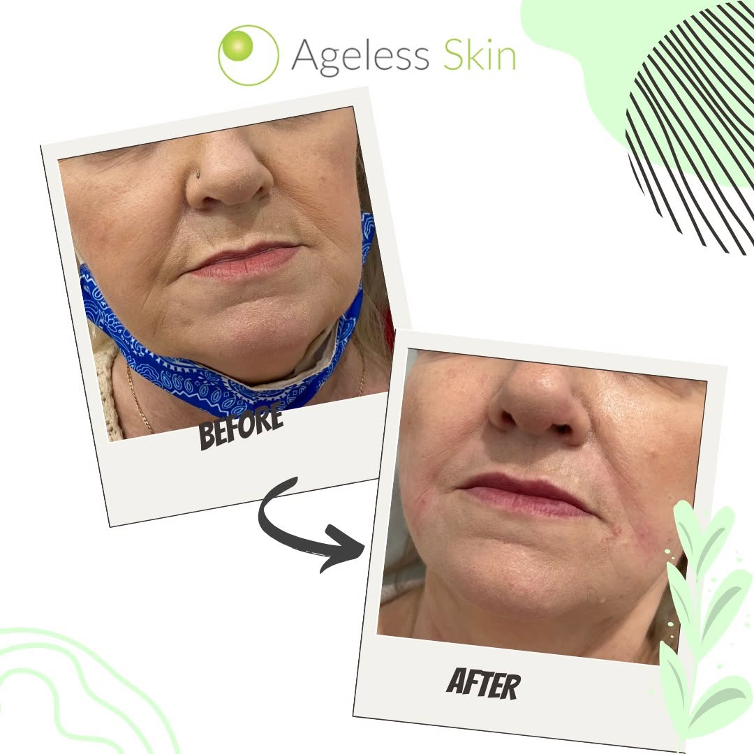 Client before and after result 5