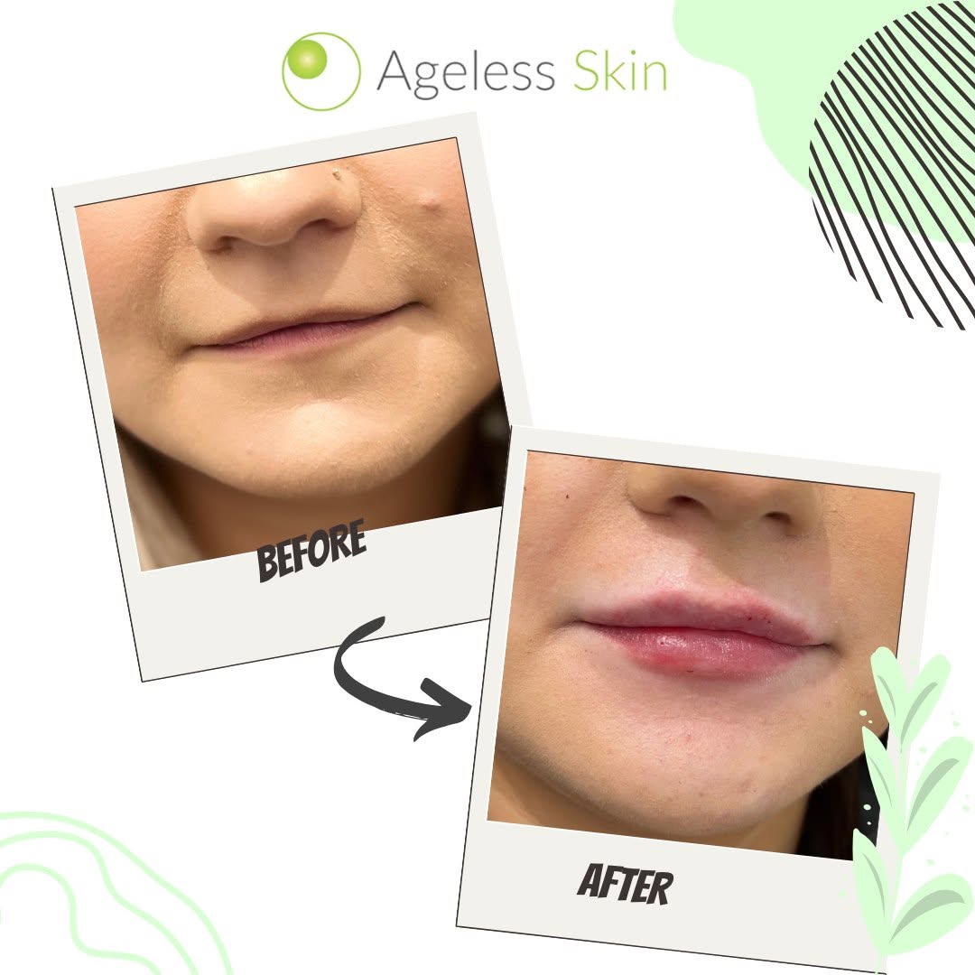 Client before and after result 8