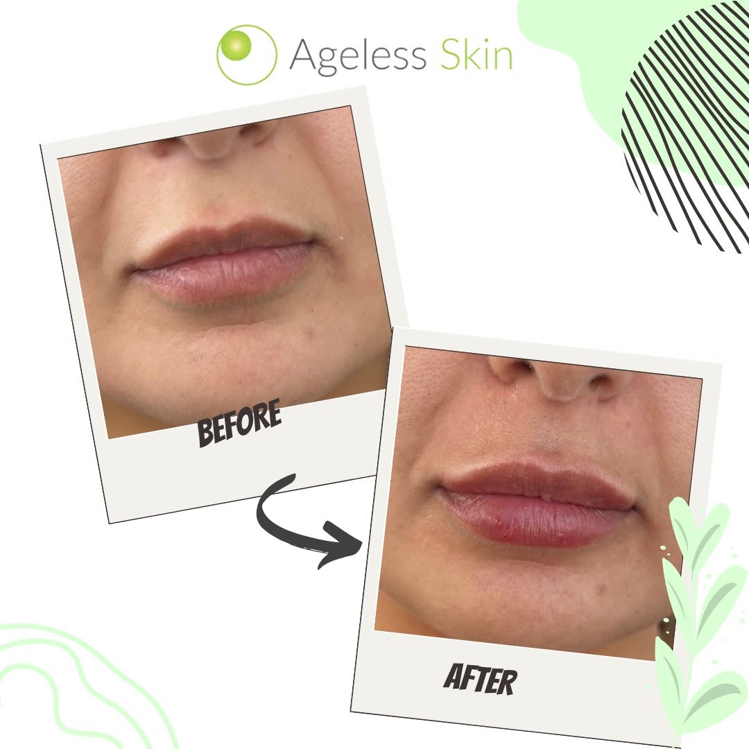 Client before and after result 7