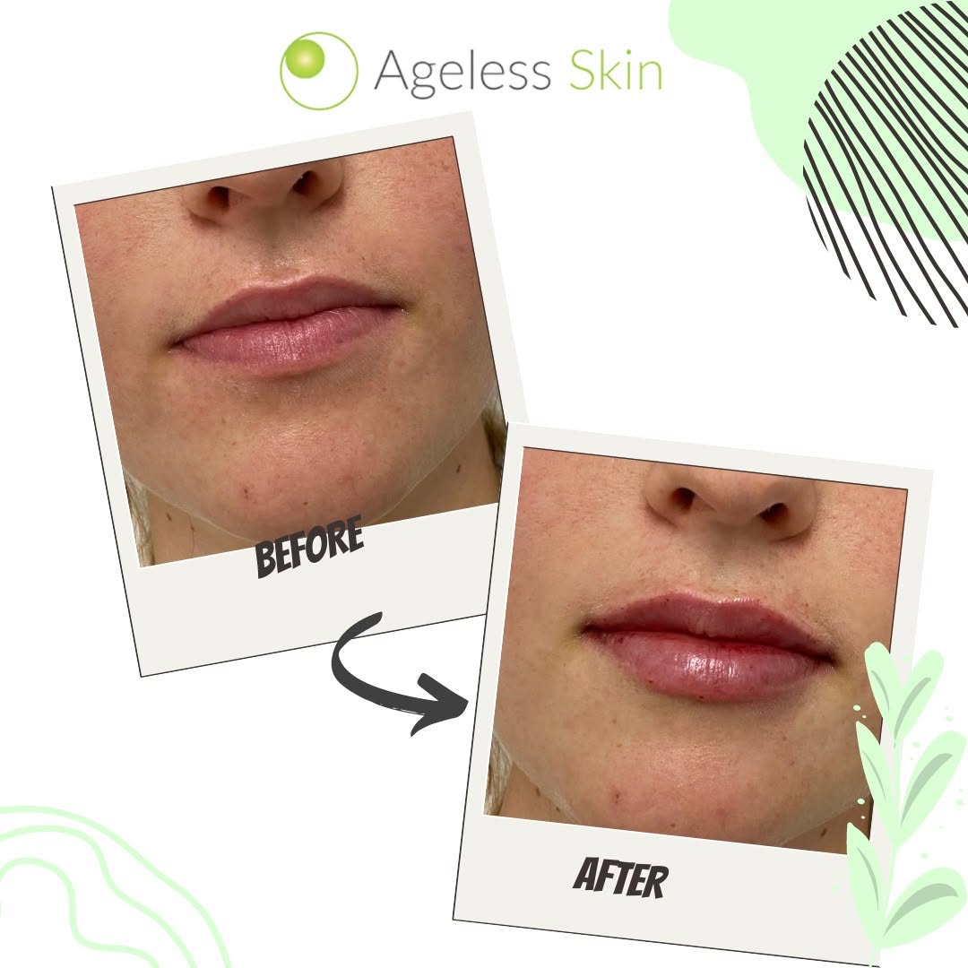 Client before and after result 3