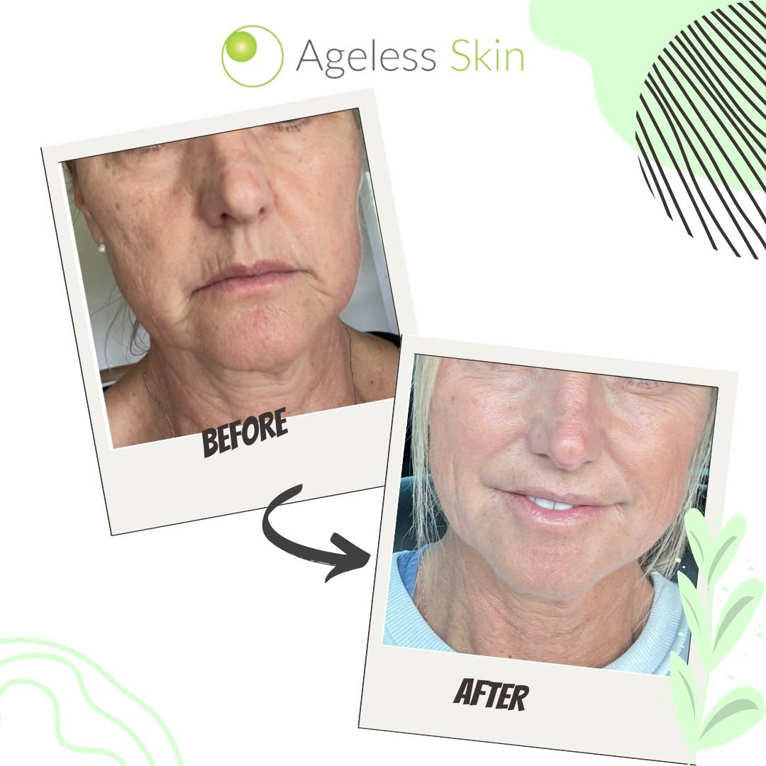 Client before and after result 1