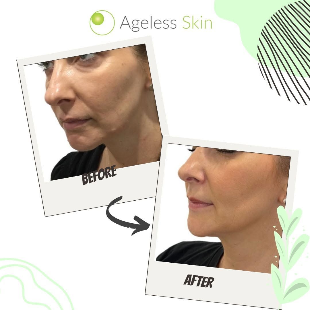 Client before and after result 4
