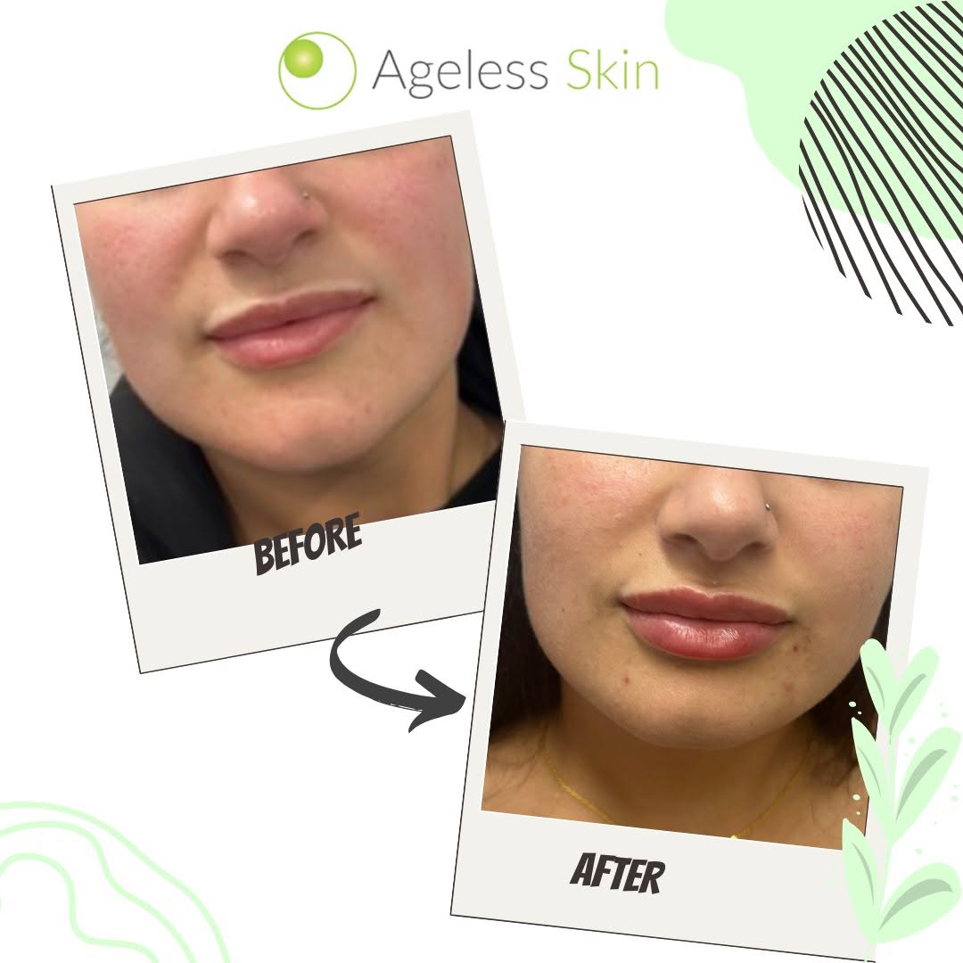 Client before and after result 2