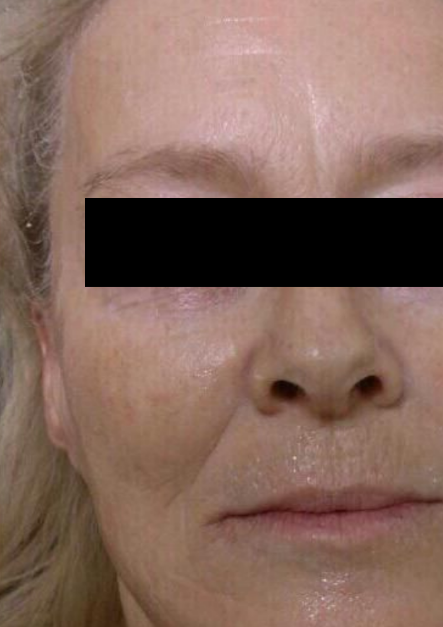 Client after treatment