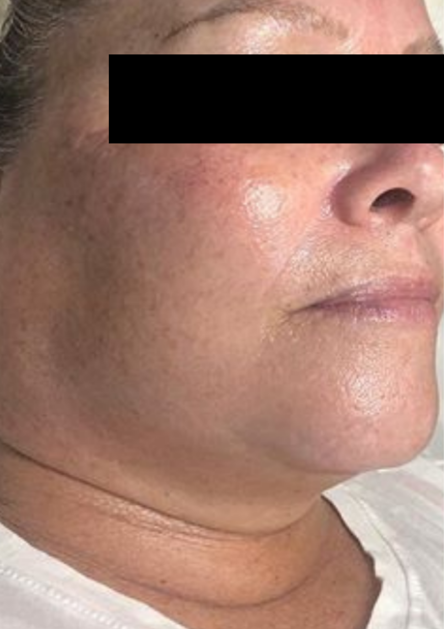 Client after treatment