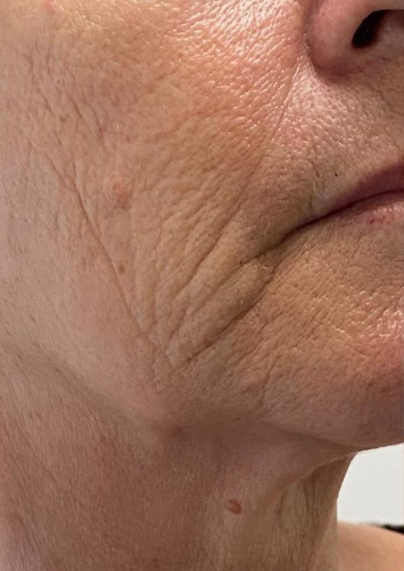 Client before treatment