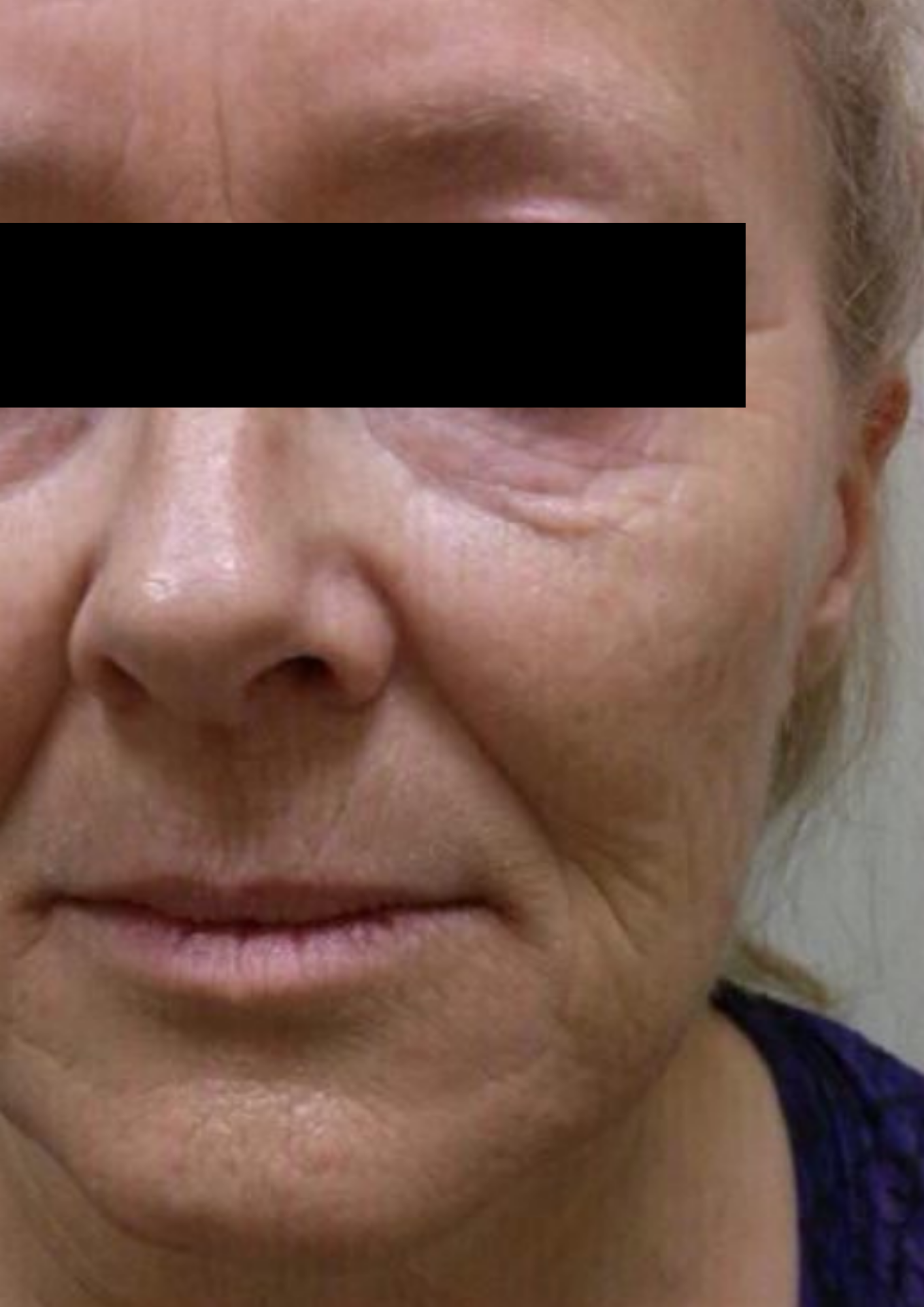 Client before treatment