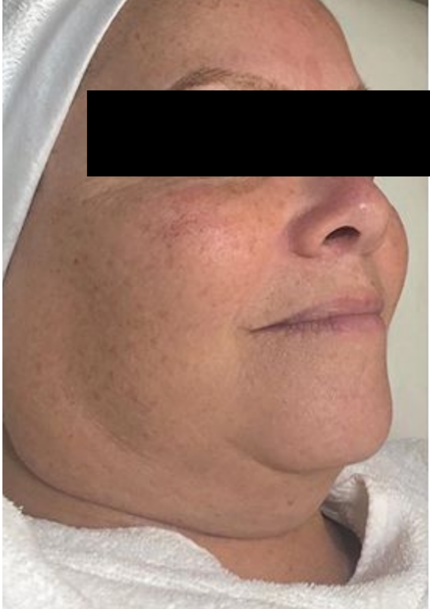 Client before treatment