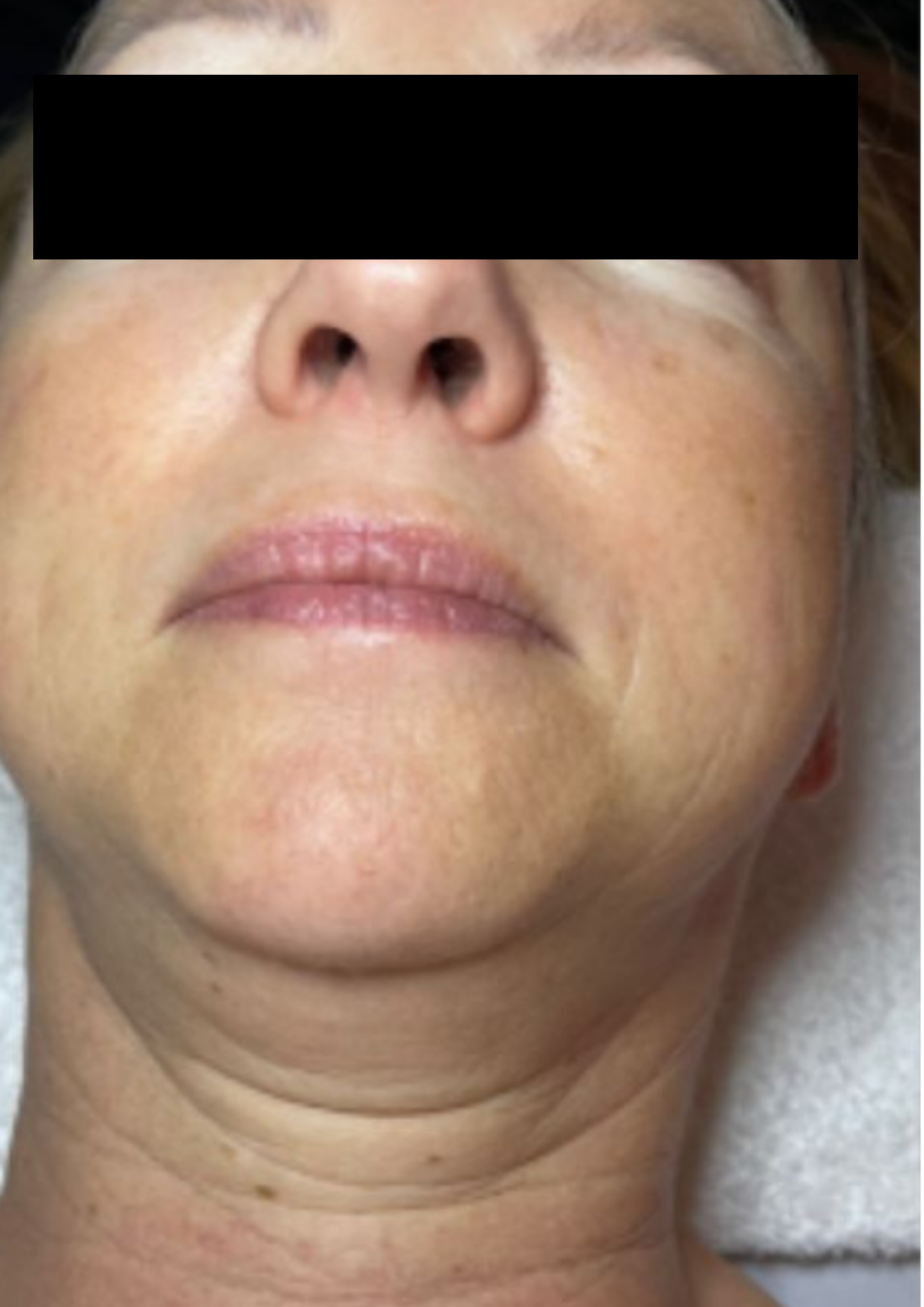 Client before treatment