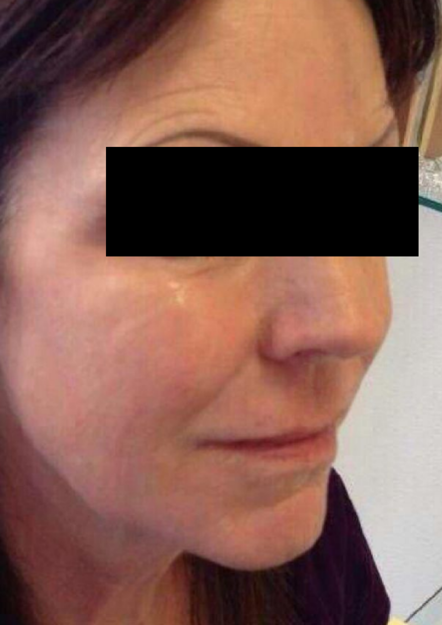 Client after treatment