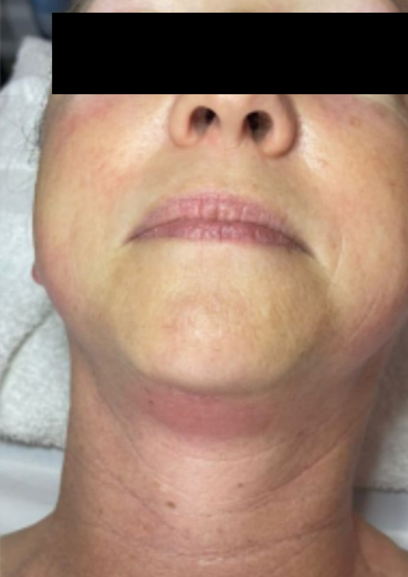 Client after treatment