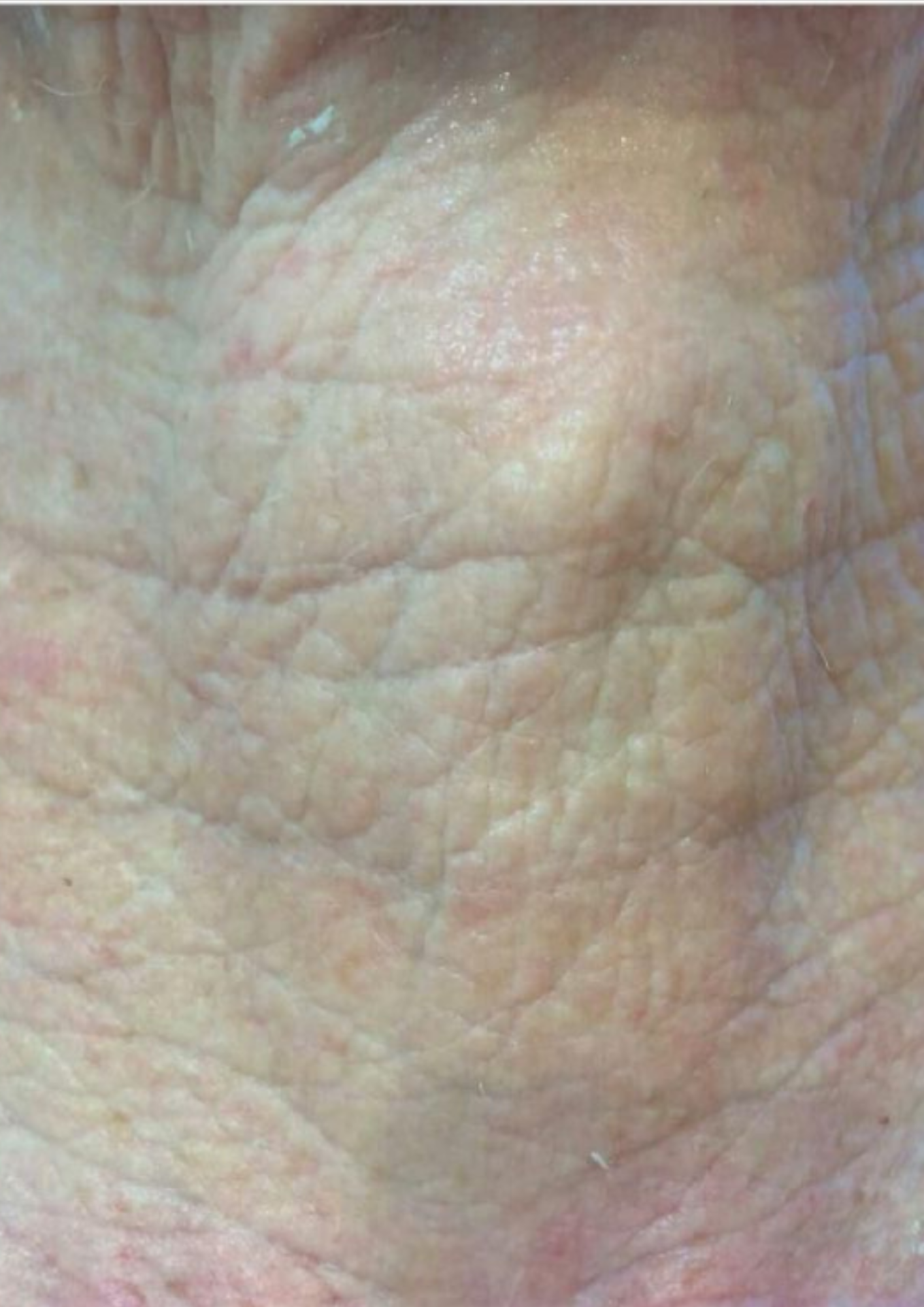 Client after treatment