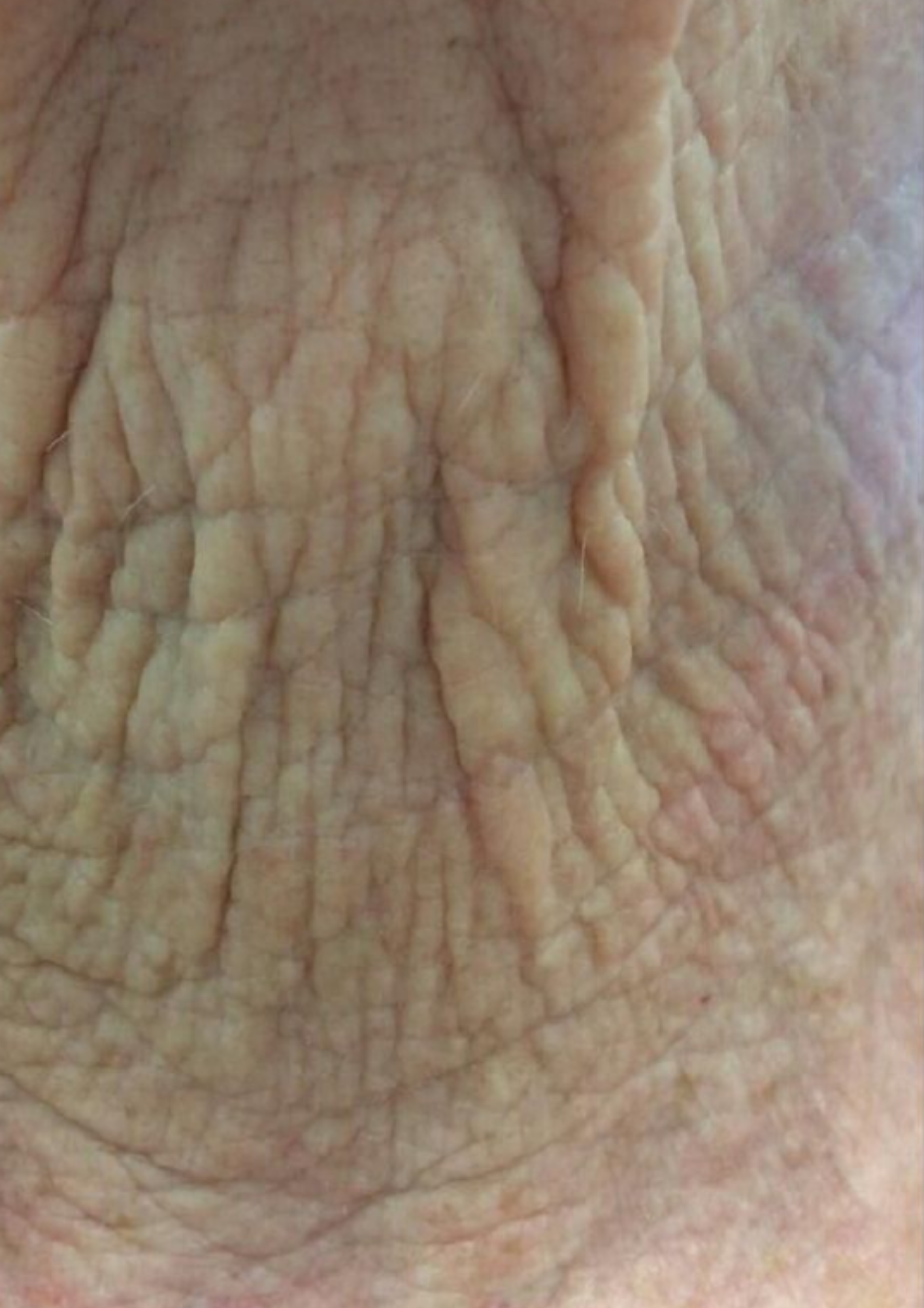 Client before treatment