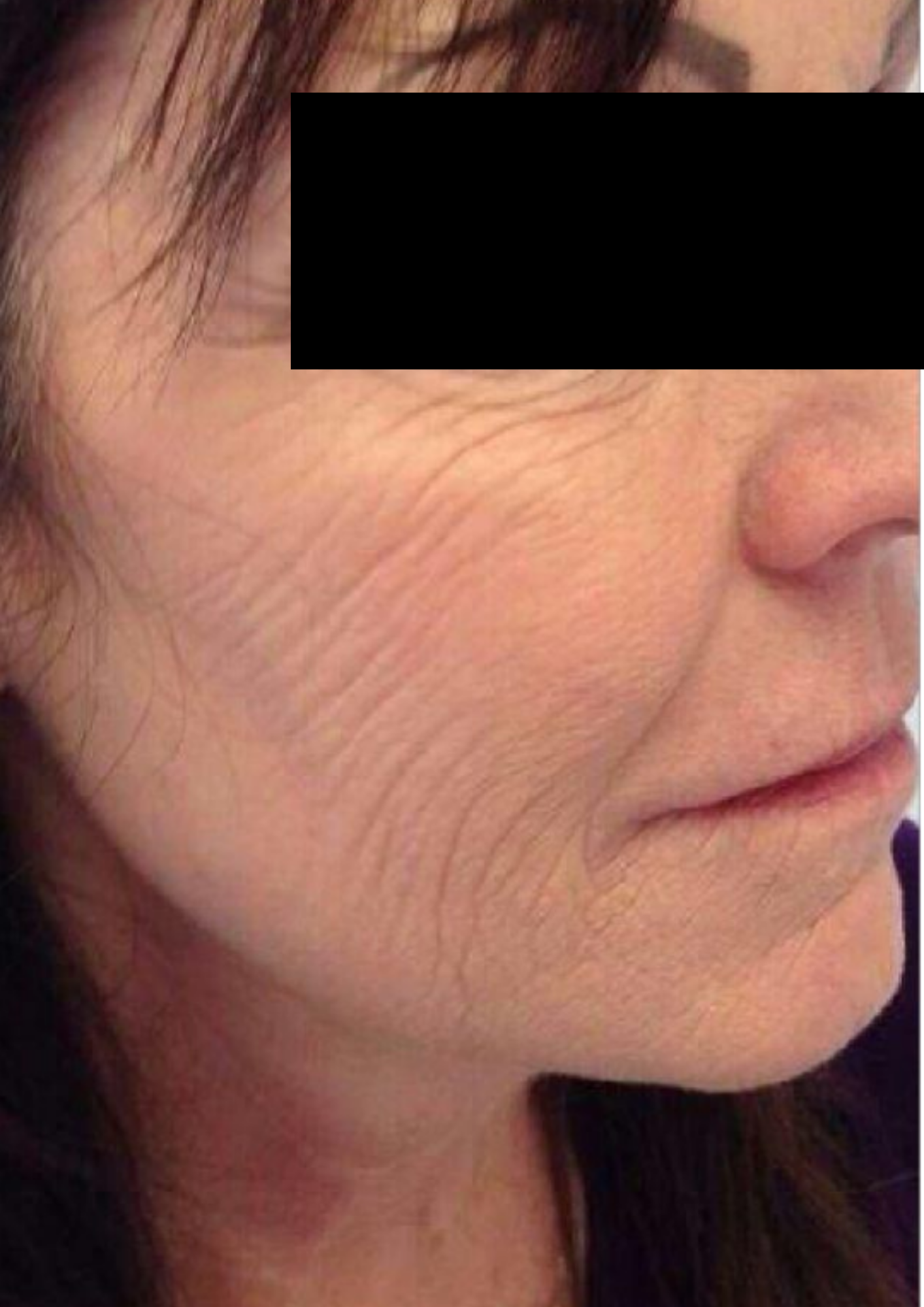 Client before treatment