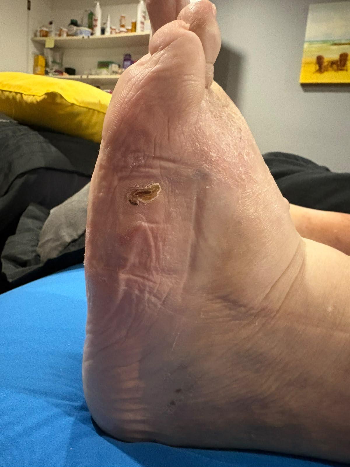 Progress during treatment