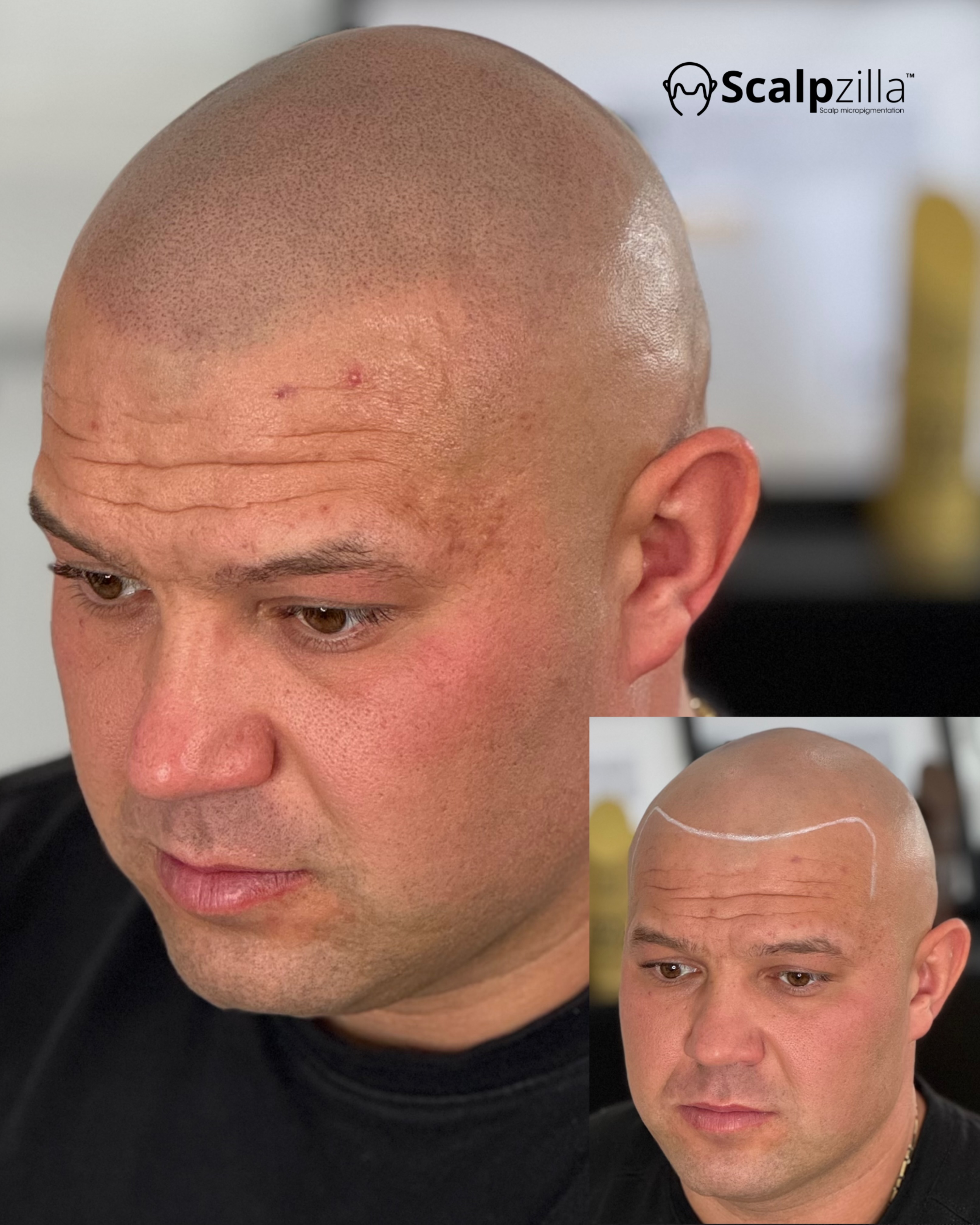 Before and After 3