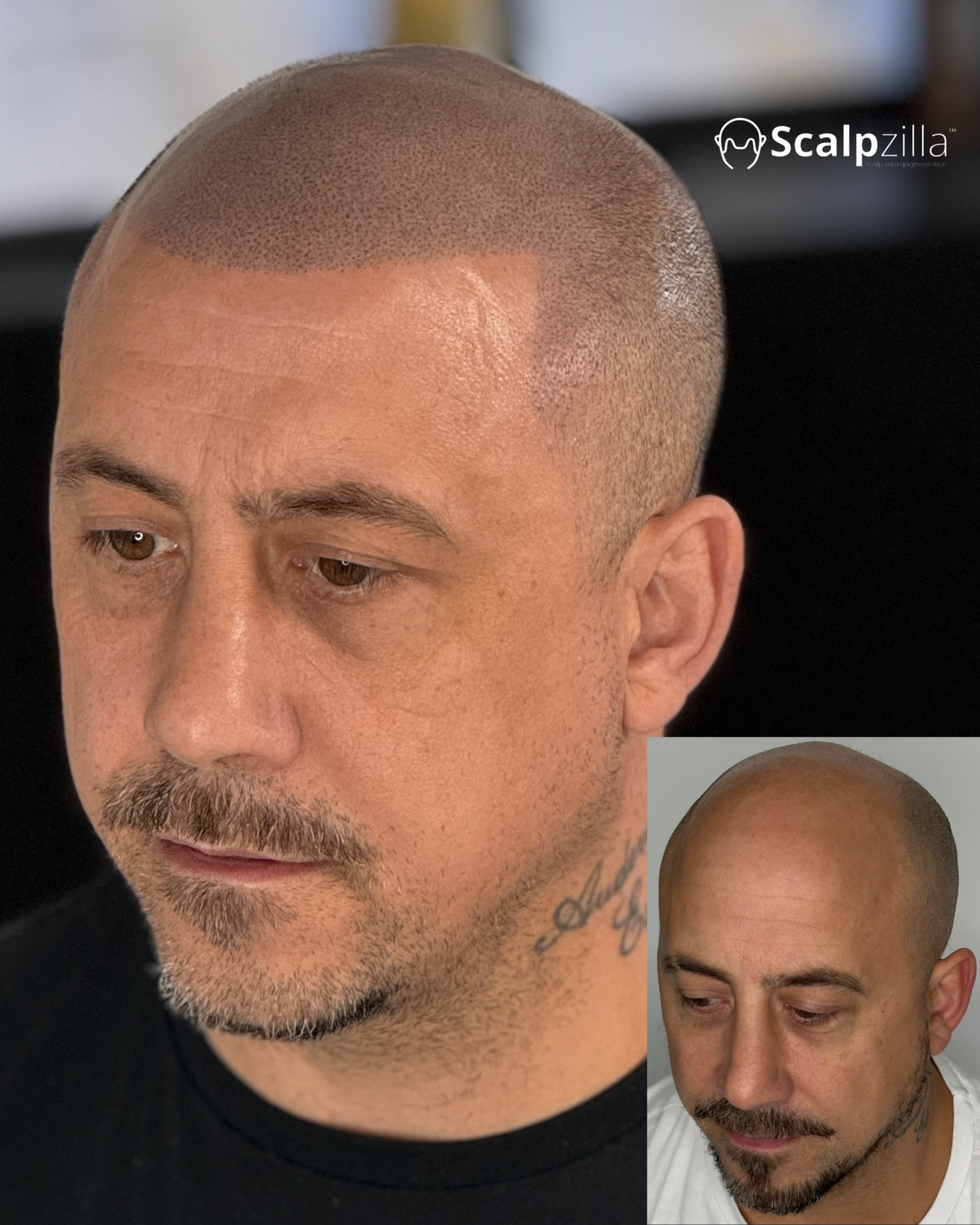 Before and After 8