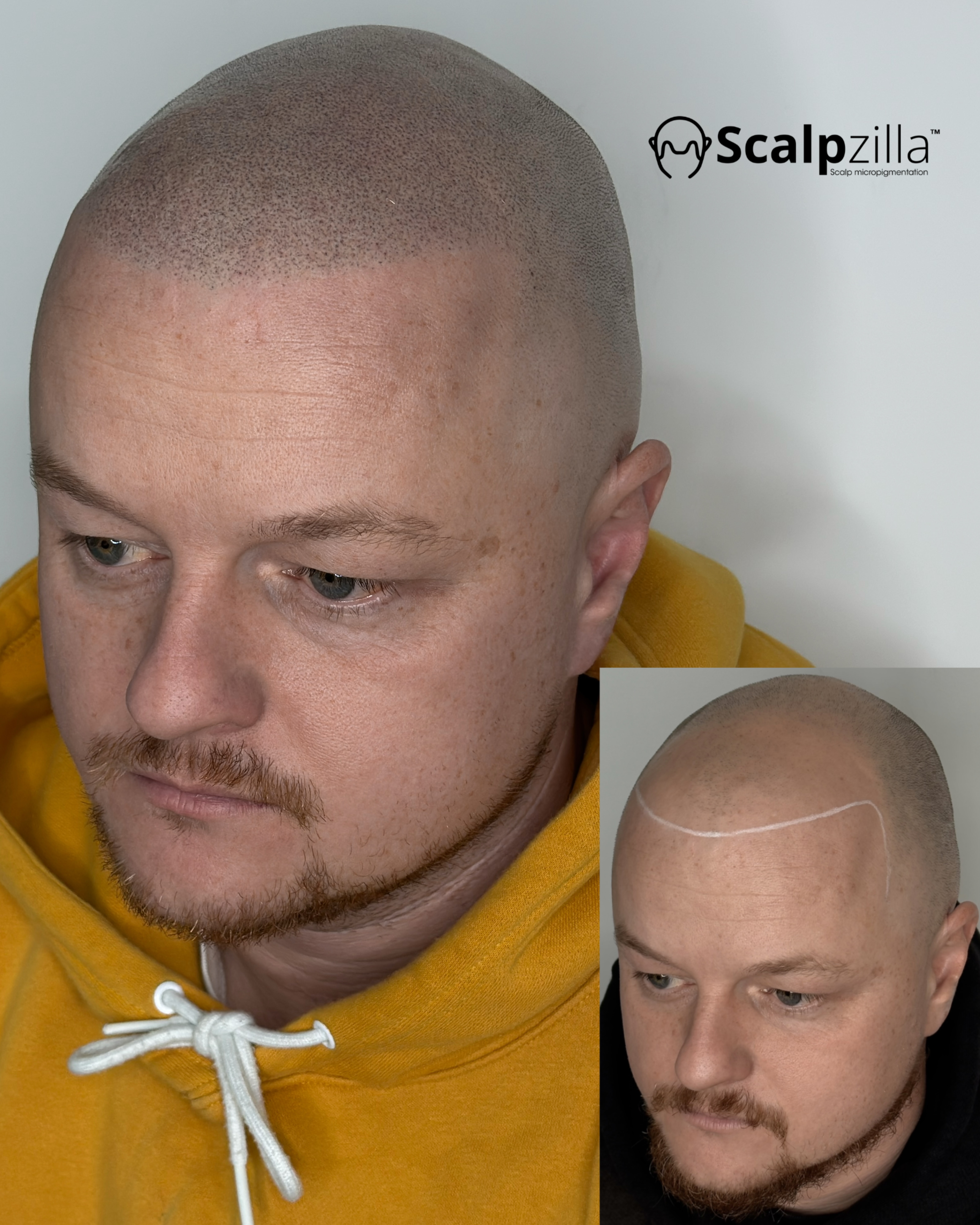 Before and After 6