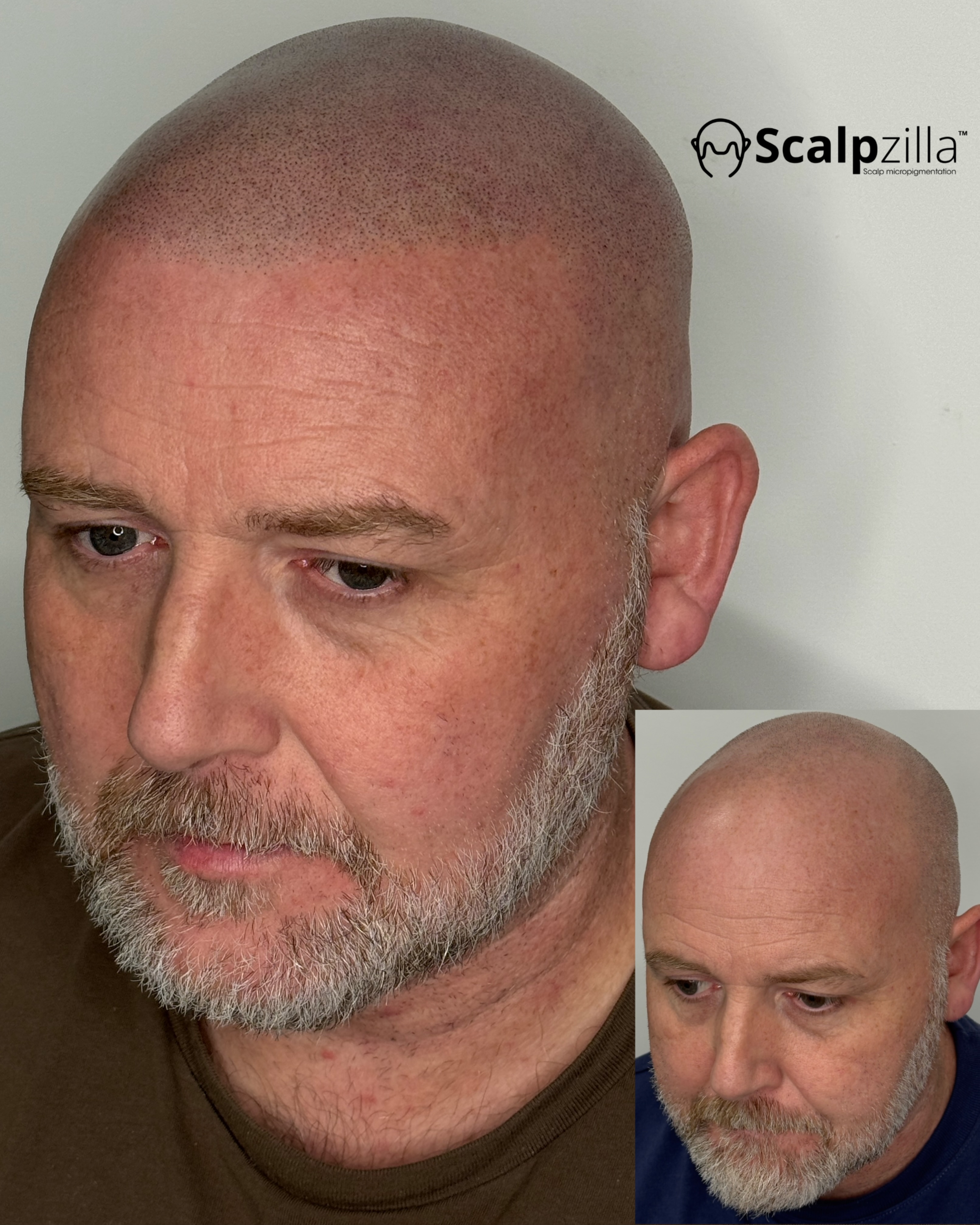 Before and After 2