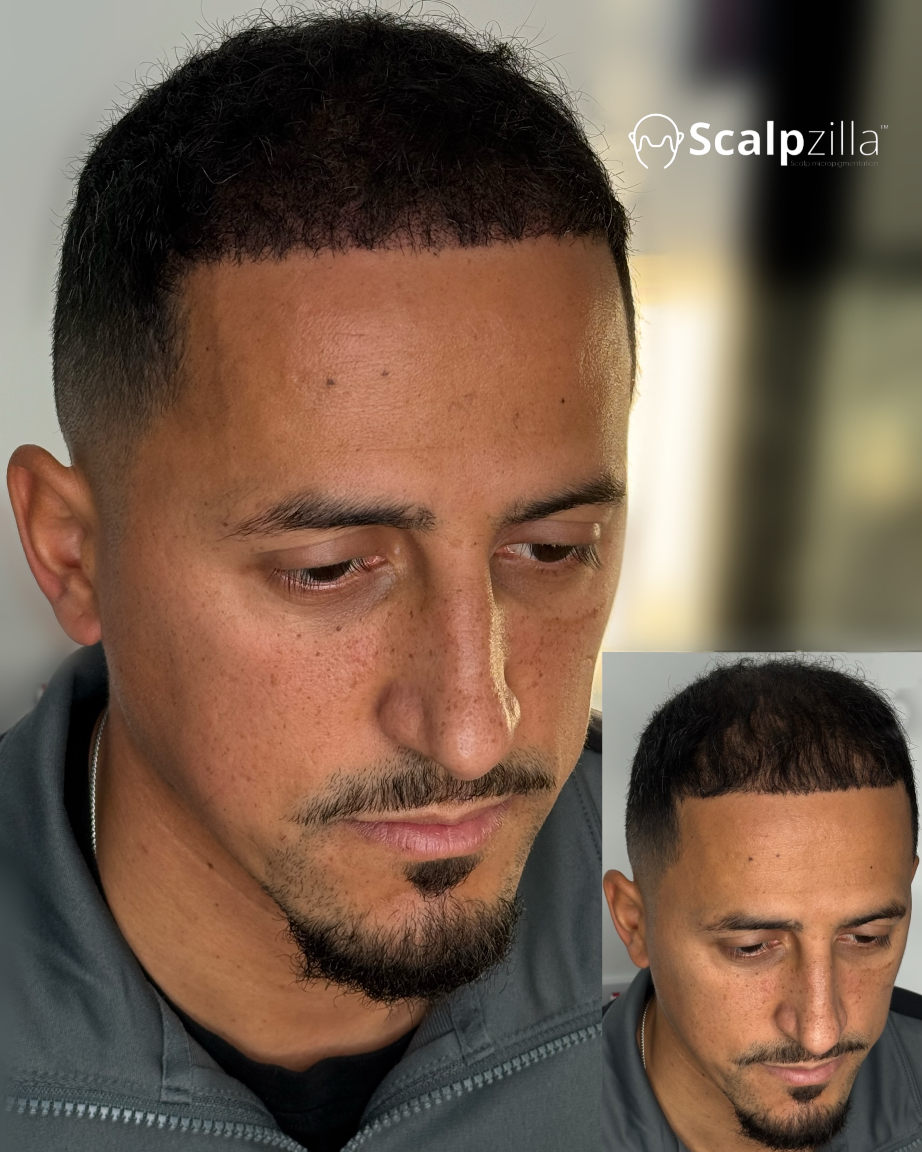 Before and After 9