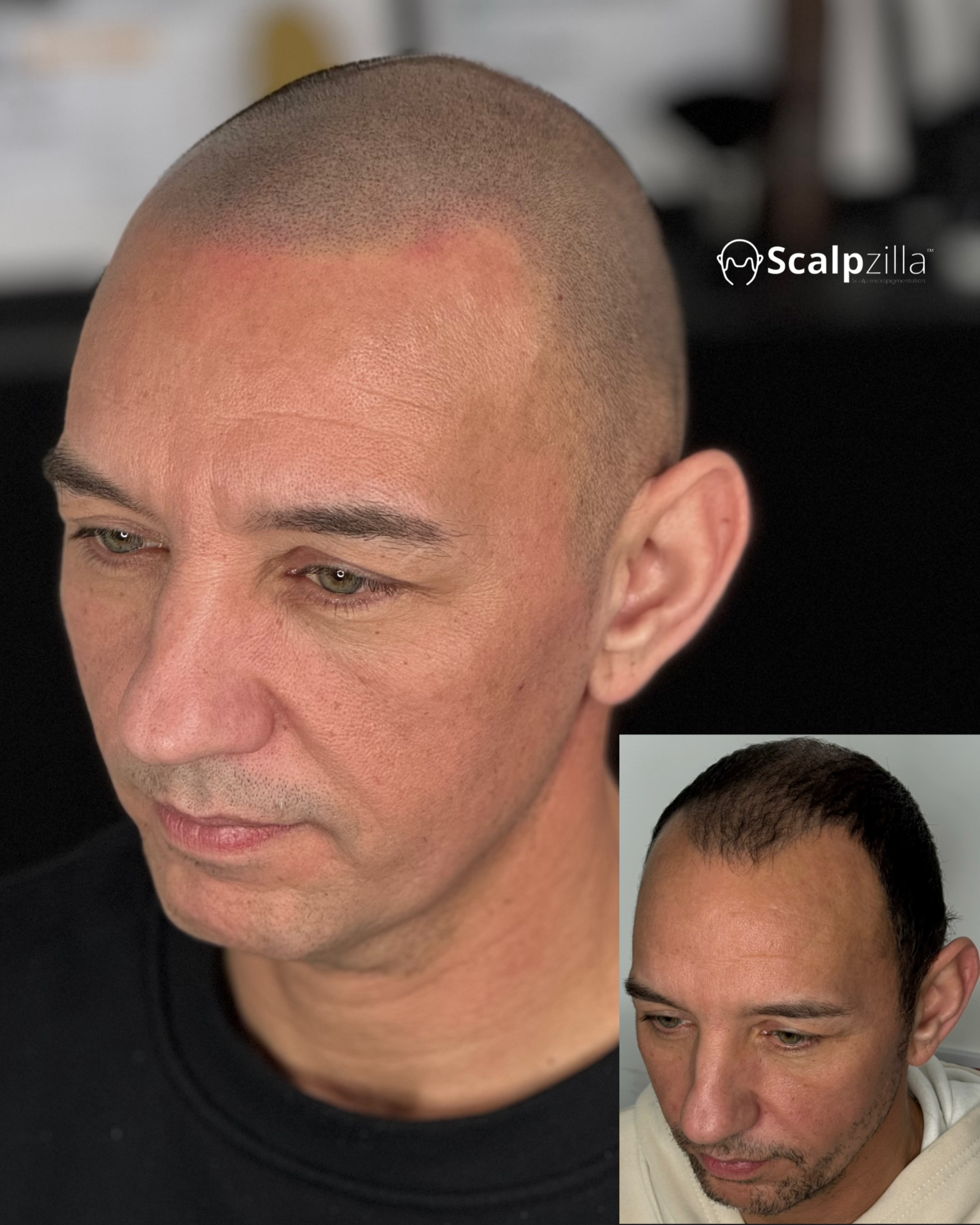 Before and After 5