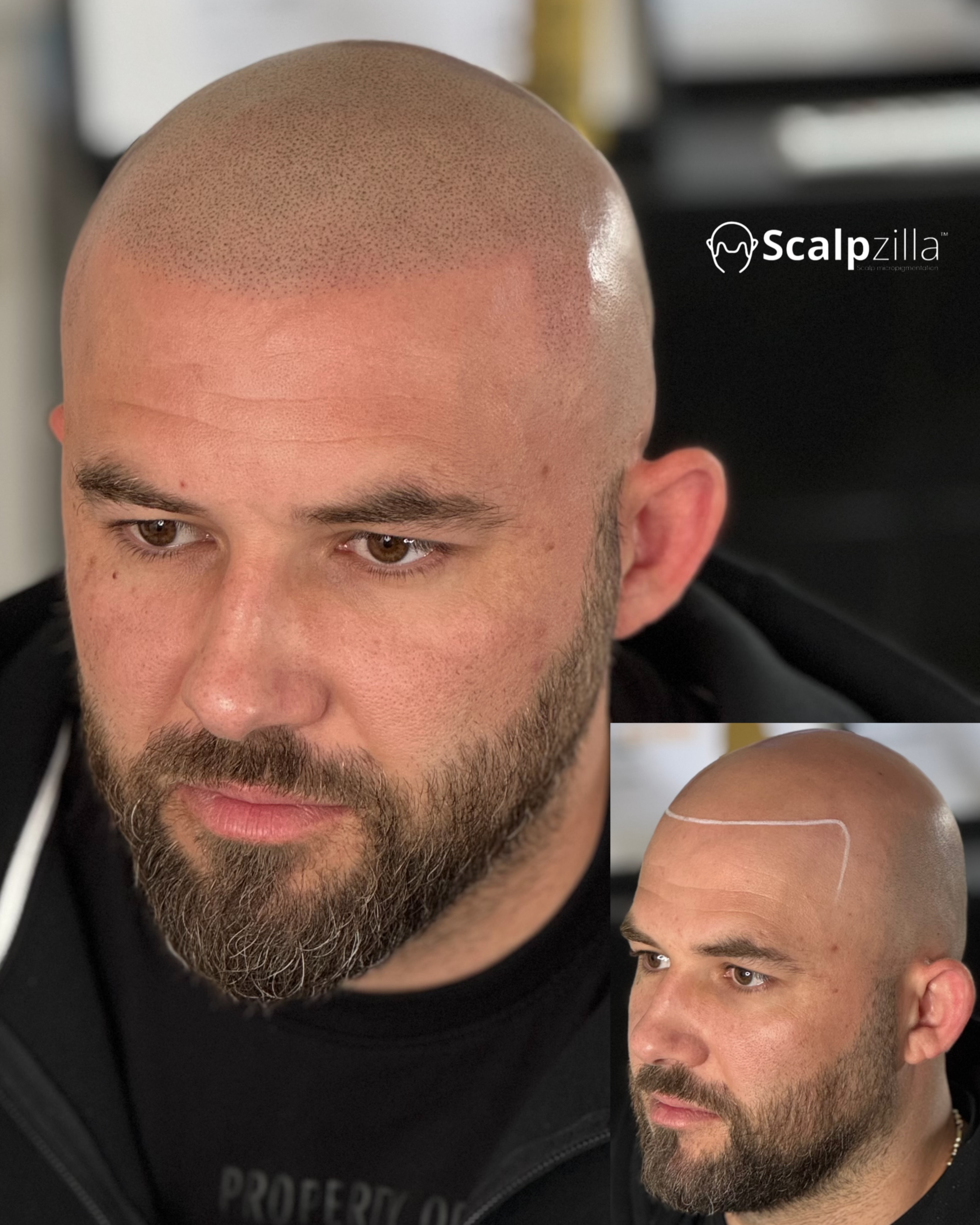 Before and After 100