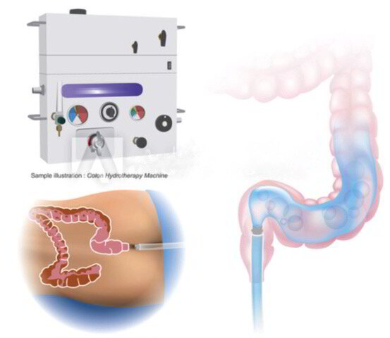Colon hydrotherapy equipment