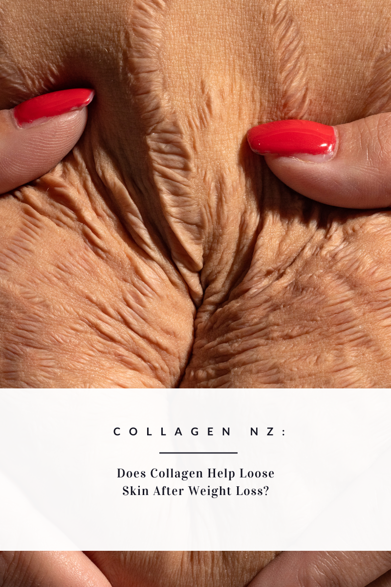 women holding together loose skin on well. Words on image says: Collagen NZ: Does Collagen Help Loose Skin After Weight Loss?