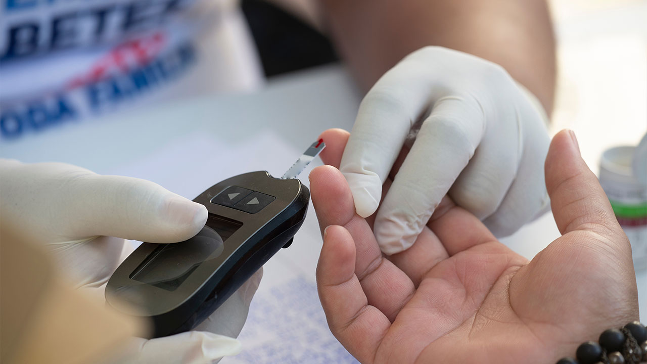Fasting Glucose Alone Doesn't Reveal Insulin Resistance