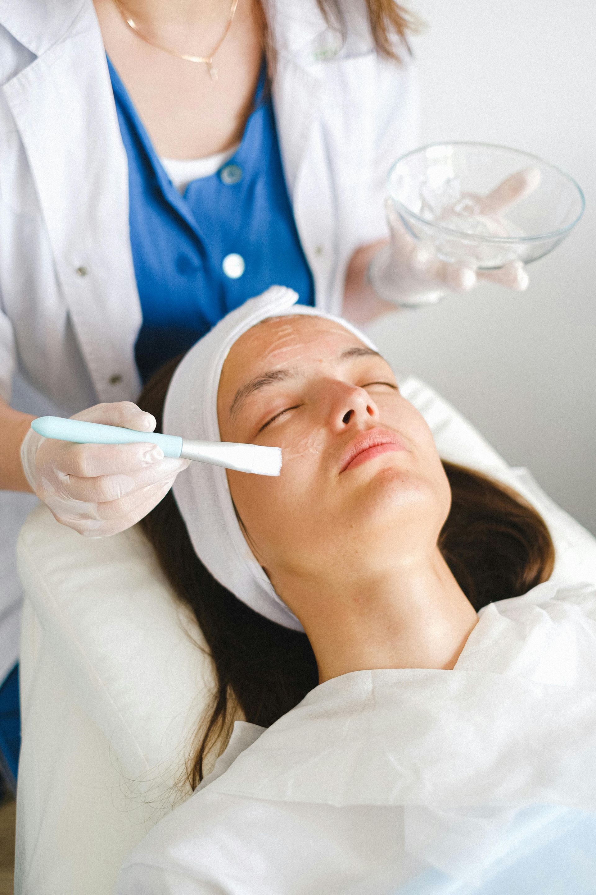 Chemical Peel