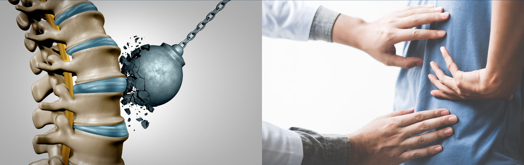 WHAT YOU SHOULD KNOW IF YOU ARE DIAGNOSED WITH A BULGING OR HERNIATED DISC