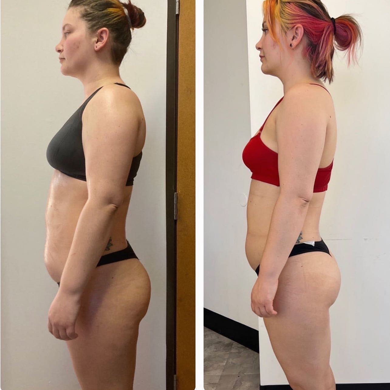 Before and after — Kimberly S., firmer arms by session three