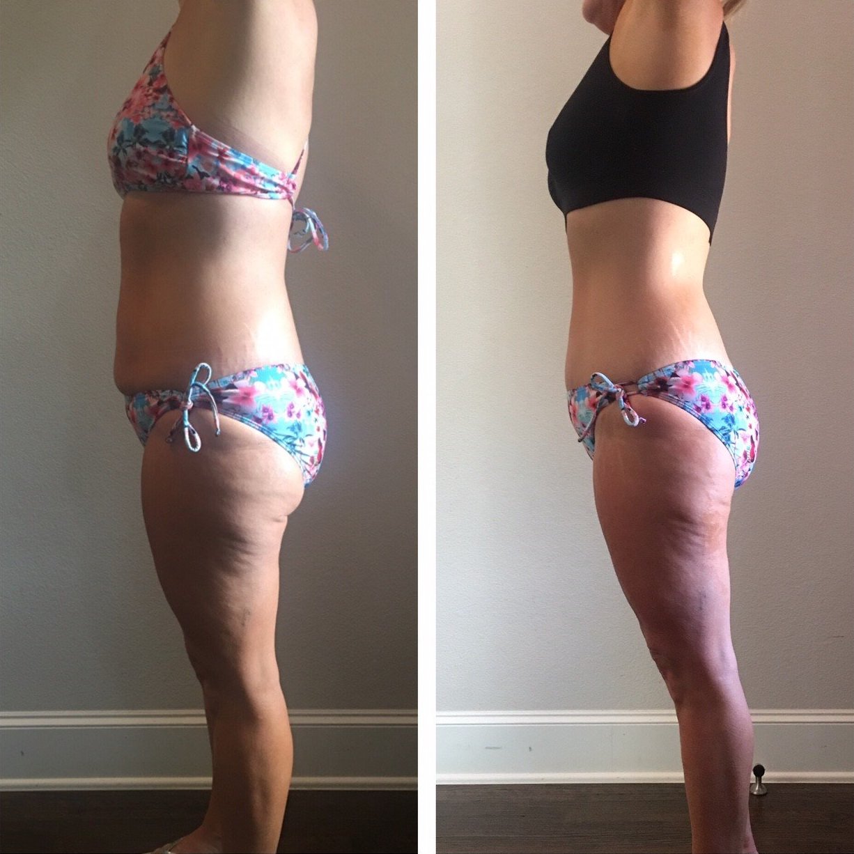 Before and after — visible waist smoothing