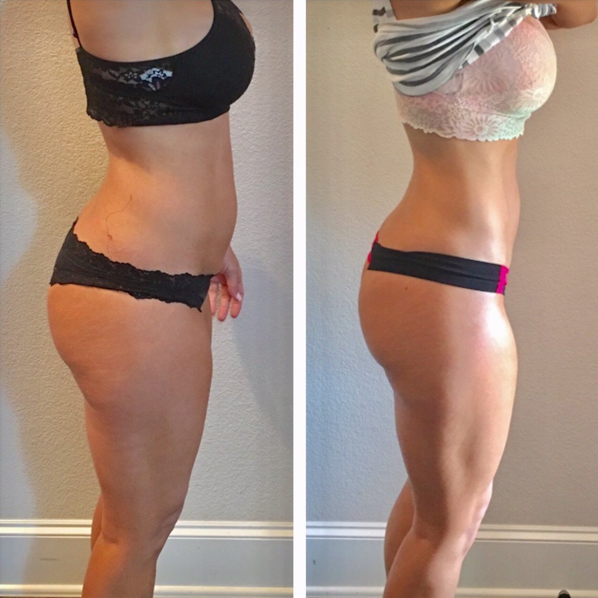 Before and after — smoother back/waistline