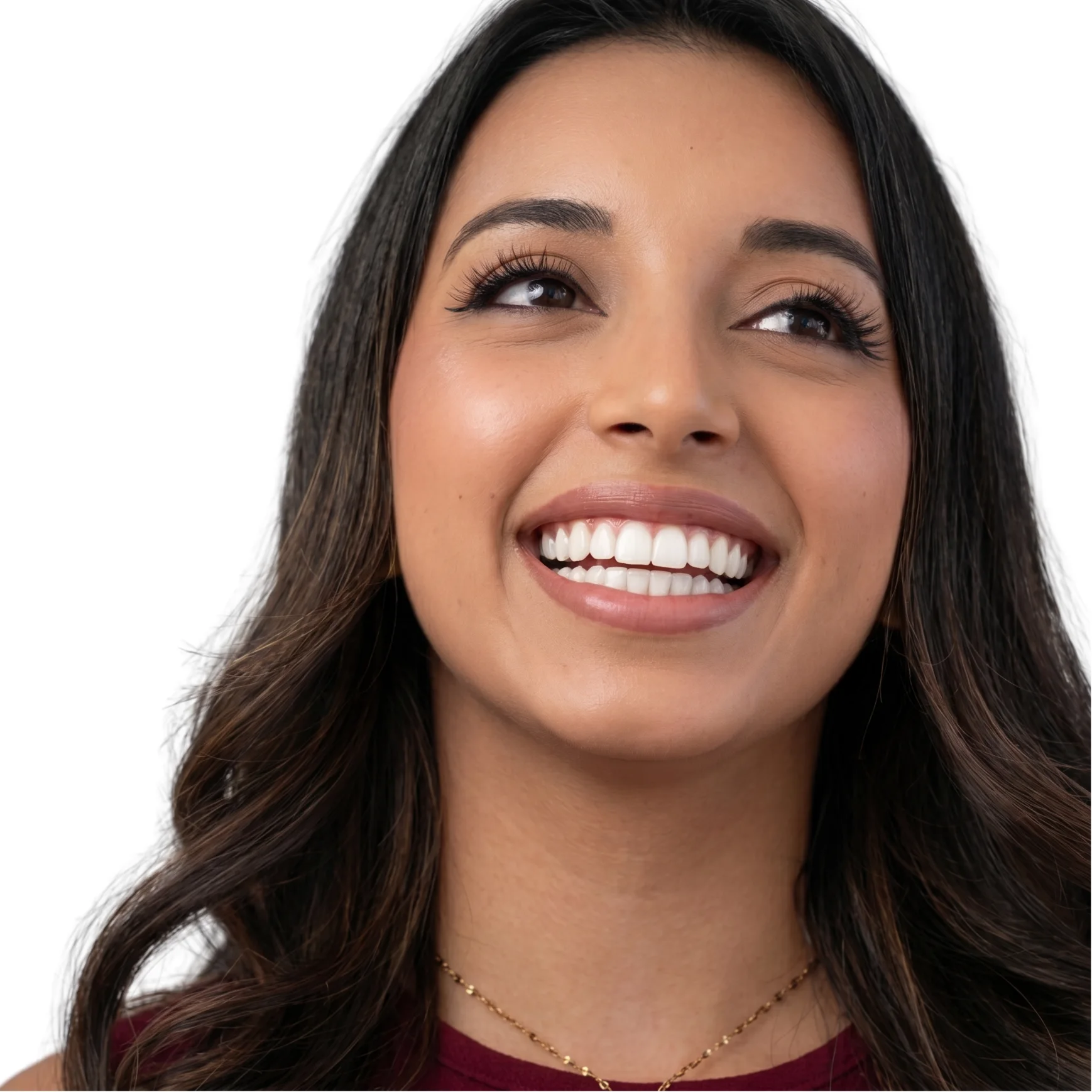 Caso de éxito: Catalina Zepeda - Diseño de Sonrisa + Carillas