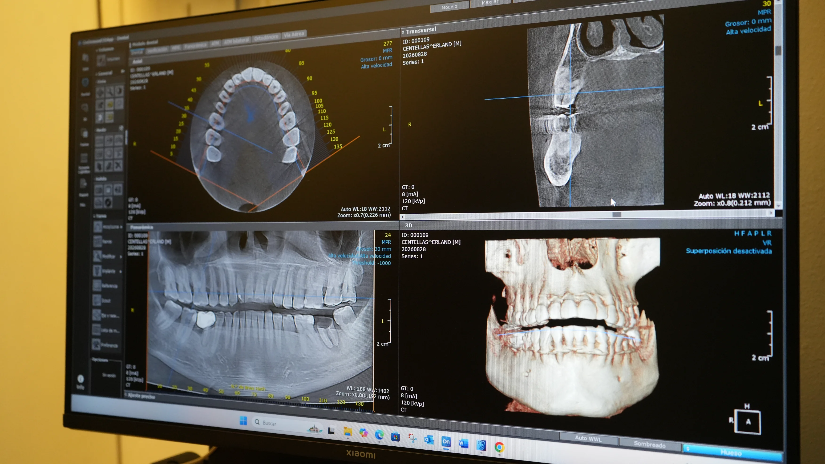 Especialistas analizando tomografía 3D en conjunto