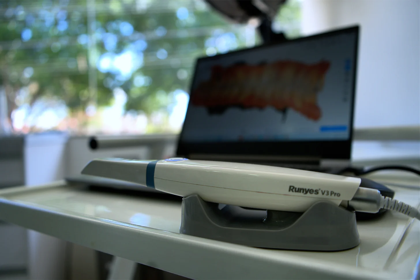 Escáner intraoral capturando anatomía dental