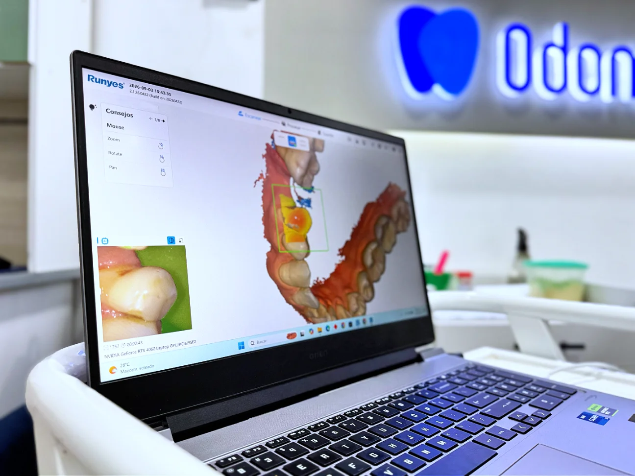 Modelo 3D digital de la boca con escáner intraoral