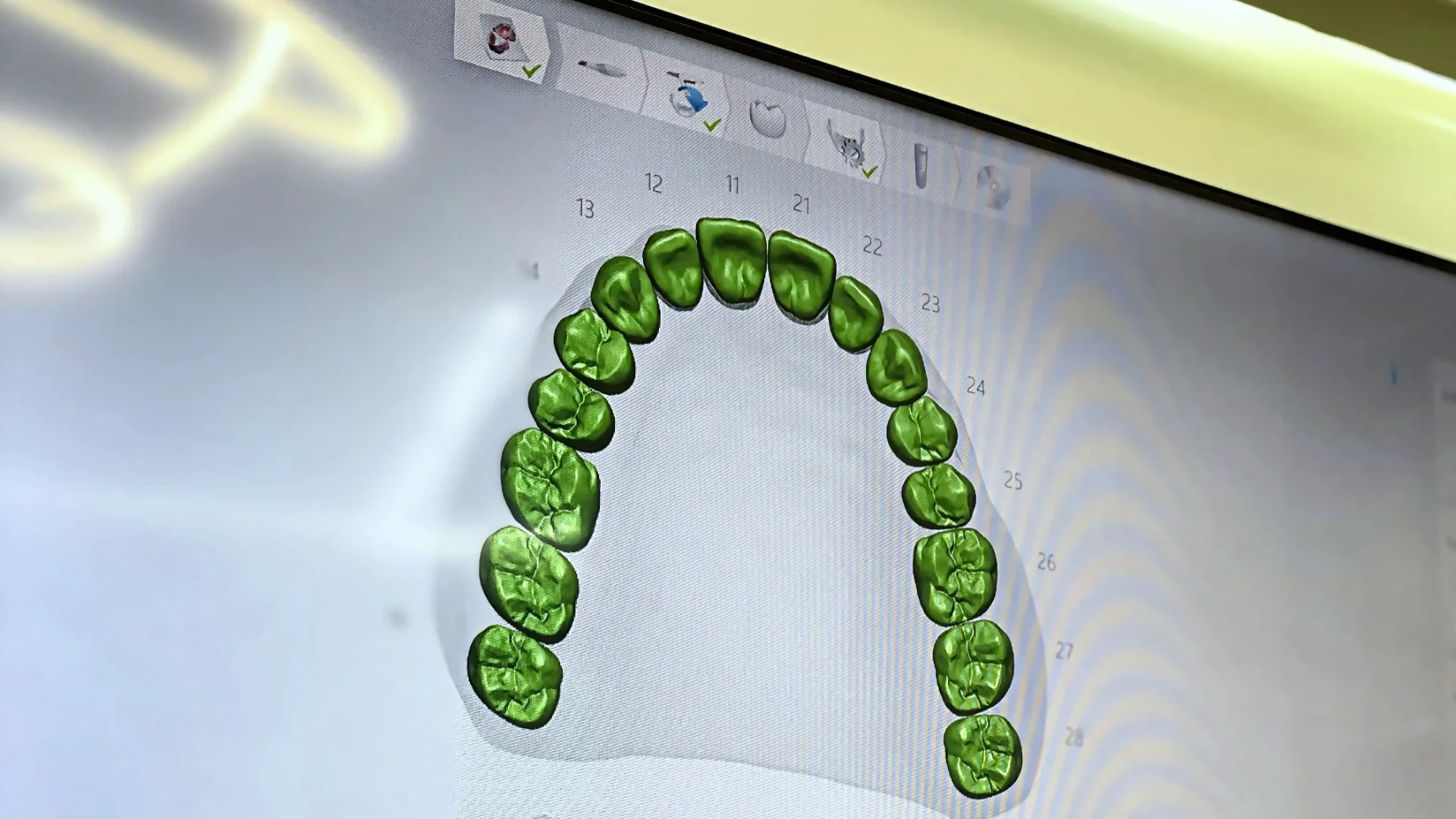 Diseño CAD/CAM de implantes y guías quirúrgicas