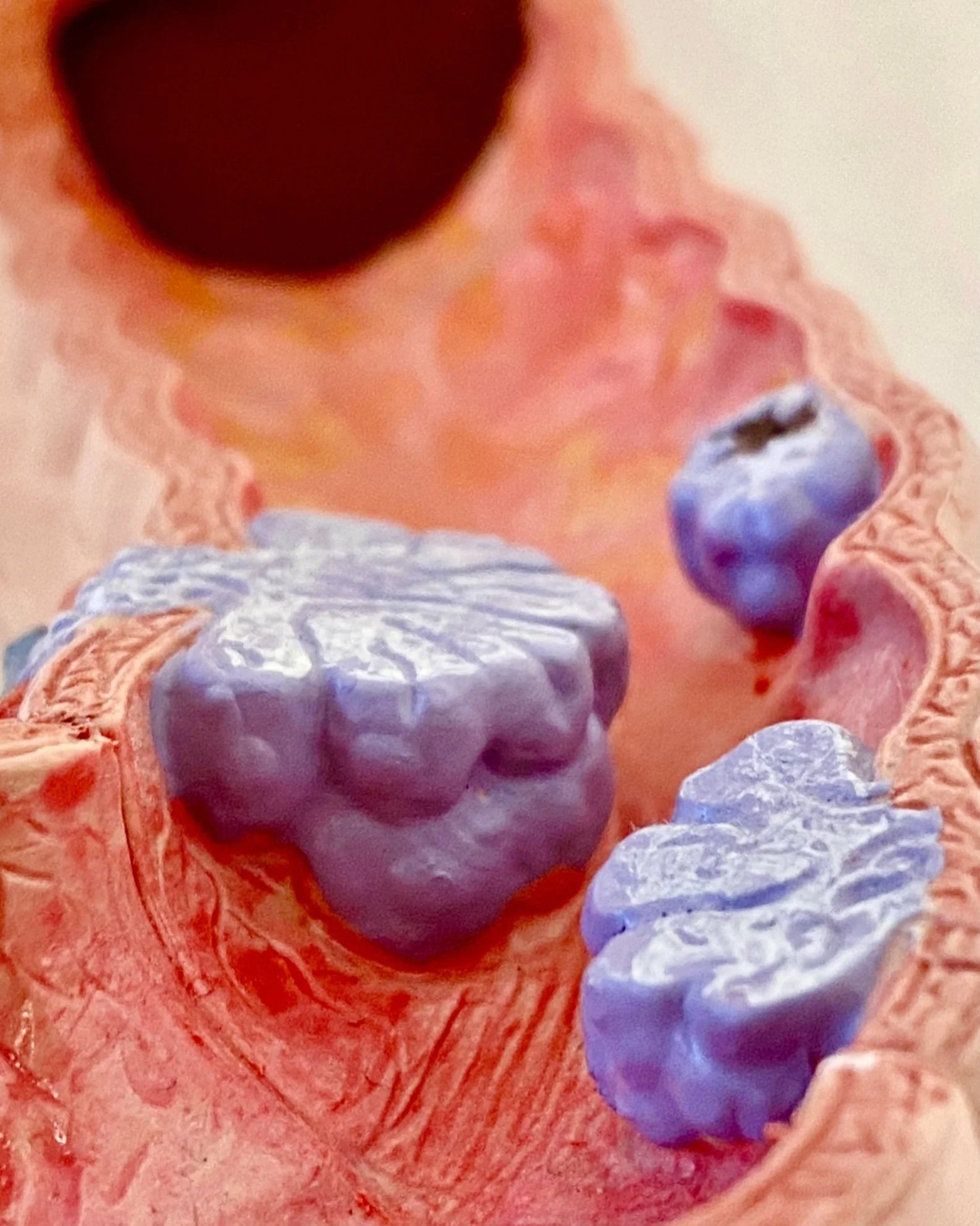 Why Does Alcohol Increase Colon Cancer Risk?