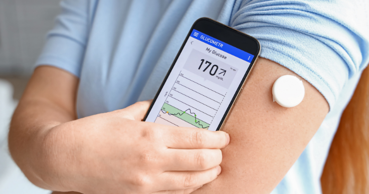 Un paciente colocándose un monitor continuo de glucosa (CGM) en el brazo para el control de la diabetes. Un paciente colocándose un monitor continuo de glucosa (CGM) en el brazo para el control de la diabetes.