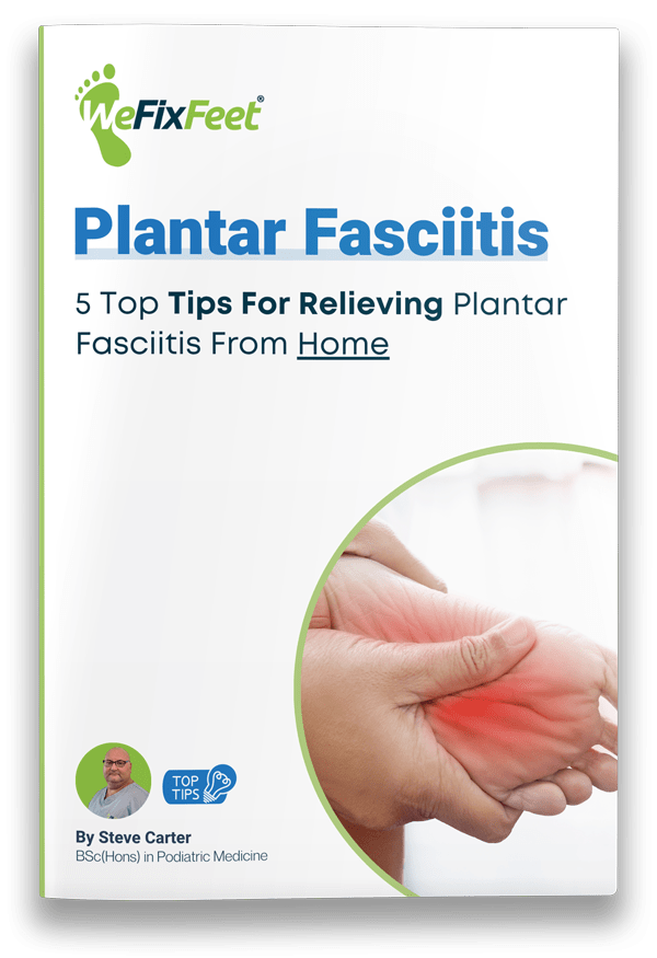 Plantar Fasciitis Treatment Derbyshire & Nottinghamshire We Fix Feet