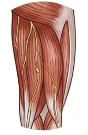 Outer thighs
