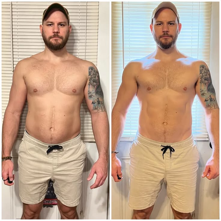 Before and after — Restart Longevity Spa
